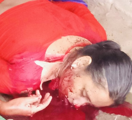 যশোরের চৌগাছায় রিক্তা খাতুন (৪০) নামের এক নারীকে হত্যা করেছে দুর্বৃত্তরা।
